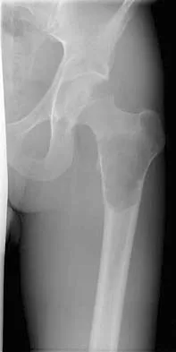 General Orthopedics Board Review 2026: High-Yield MCQs (Set 4) - Figure 9