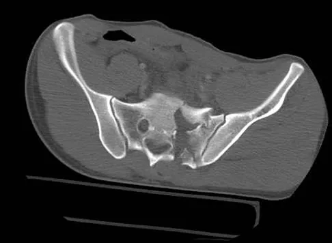 General Orthopedics 2026 Practice Questions: Set 5 (Solved) - Figure 100
