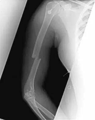General Orthopedics 2026 Practice Questions: Set 5 (Solved) - Figure 102