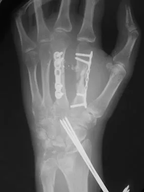 General Orthopedics 2026 Practice Questions: Set 5 (Solved) - Figure 111