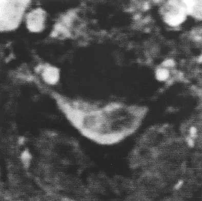 General Orthopedics 2026 Practice Questions: Set 5 (Solved) - Figure 16