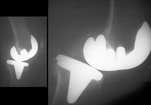 General Orthopedics 2026 Practice Questions: Set 5 (Solved) - Figure 19
