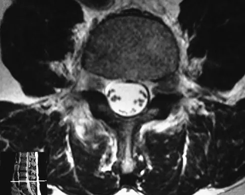 General Orthopedics 2026 Practice Questions: Set 5 (Solved) - Figure 2