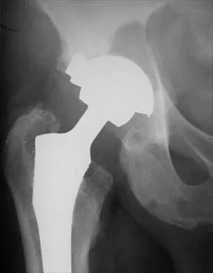 General Orthopedics 2026 Practice Questions: Set 5 (Solved) - Figure 21