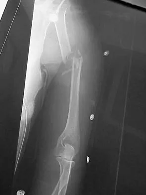 General Orthopedics 2026 Practice Questions: Set 5 (Solved) - Figure 27