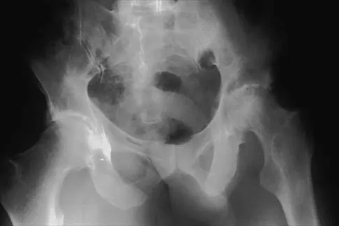General Orthopedics 2026 Practice Questions: Set 5 (Solved) - Figure 38