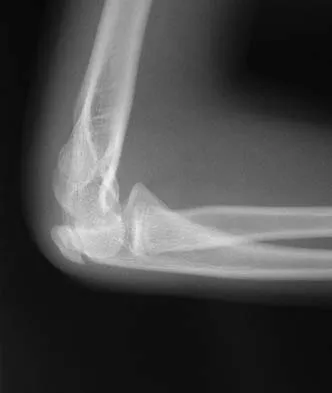 General Orthopedics 2026 Practice Questions: Set 5 (Solved) - Figure 4