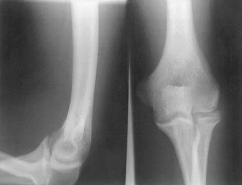 General Orthopedics 2026 Practice Questions: Set 5 (Solved) - Figure 40