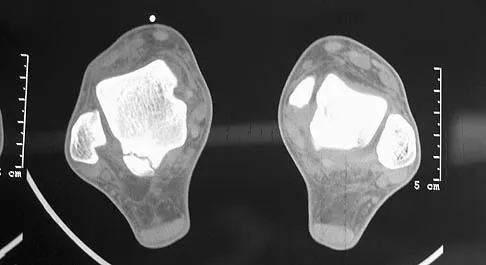 General Orthopedics 2026 Practice Questions: Set 5 (Solved) - Figure 41