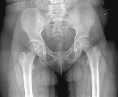 General Orthopedics 2026 Practice Questions: Set 5 (Solved) - Figure 43