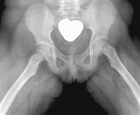 General Orthopedics 2026 Practice Questions: Set 5 (Solved) - Figure 44