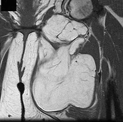 General Orthopedics 2026 Practice Questions: Set 5 (Solved) - Figure 45