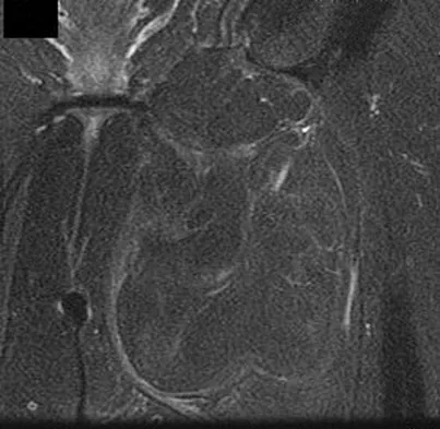 General Orthopedics 2026 Practice Questions: Set 5 (Solved) - Figure 46