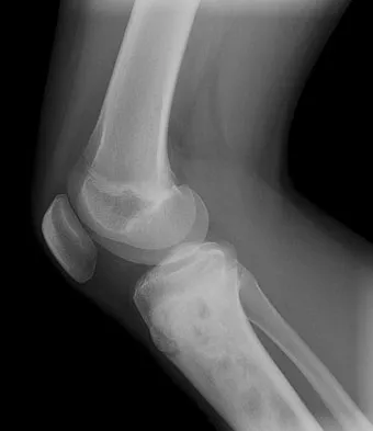 General Orthopedics 2026 Practice Questions: Set 5 (Solved) - Figure 51