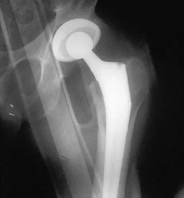 General Orthopedics 2026 Practice Questions: Set 5 (Solved) - Figure 52