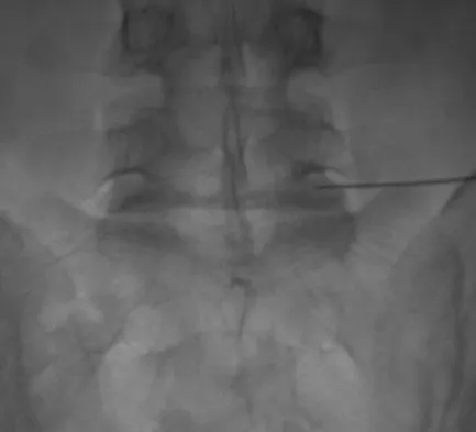 General Orthopedics 2026 Practice Questions: Set 5 (Solved) - Figure 54