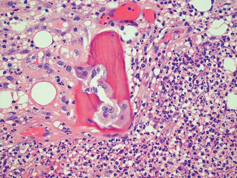 General Orthopedics 2026 Practice Questions: Set 5 (Solved) - Figure 56
