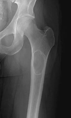 General Orthopedics 2026 Practice Questions: Set 5 (Solved) - Figure 60