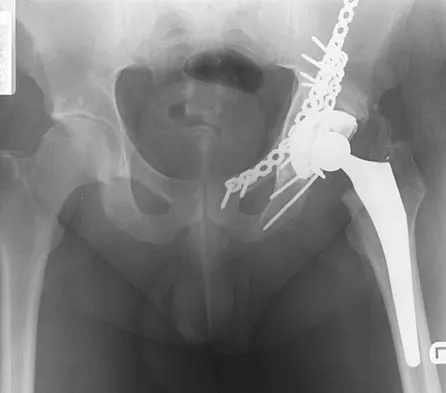 General Orthopedics 2026 Practice Questions: Set 5 (Solved) - Figure 65