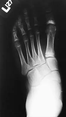 General Orthopedics 2026 Practice Questions: Set 5 (Solved) - Figure 67