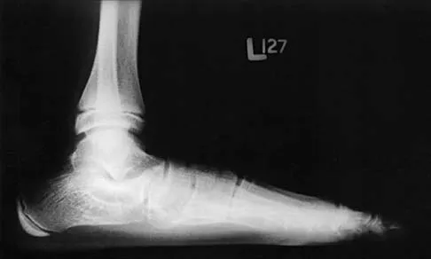 General Orthopedics 2026 Practice Questions: Set 5 (Solved) - Figure 68