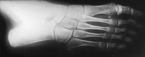 General Orthopedics 2026 Practice Questions: Set 5 (Solved) - Figure 69