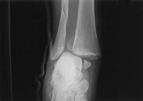 General Orthopedics 2026 Practice Questions: Set 5 (Solved) - Figure 70