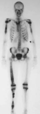General Orthopedics 2026 Practice Questions: Set 5 (Solved) - Figure 74