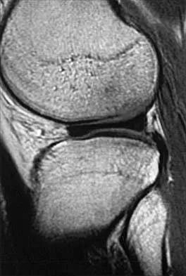 General Orthopedics 2026 Practice Questions: Set 5 (Solved) - Figure 78