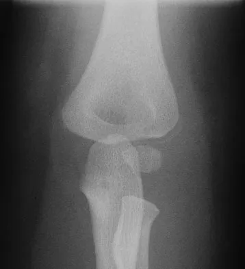 General Orthopedics 2026 Practice Questions: Set 5 (Solved) - Figure 8