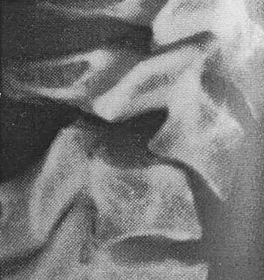 General Orthopedics 2026 Practice Questions: Set 5 (Solved) - Figure 84