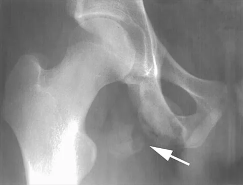 General Orthopedics 2026 Practice Questions: Set 5 (Solved) - Figure 89