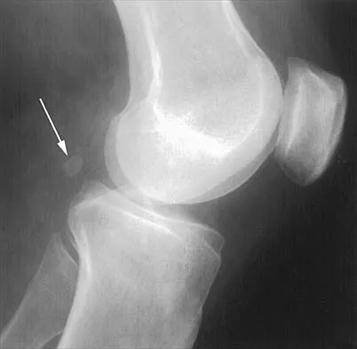 General Orthopedics 2026 Practice Questions: Set 5 (Solved) - Figure 92