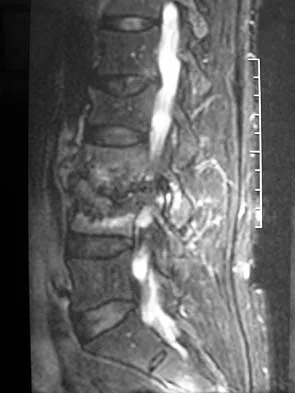 General Orthopedics 2026 Practice Questions: Set 5 (Solved) - Figure 95