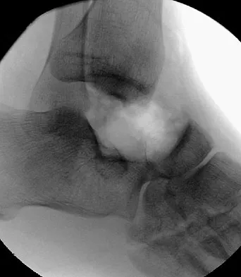General Orthopedics Board Review 2026: High-Yield MCQs (Set 6) - Figure 10
