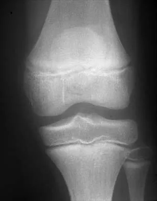 General Orthopedics Board Review 2026: High-Yield MCQs (Set 6) - Figure 101