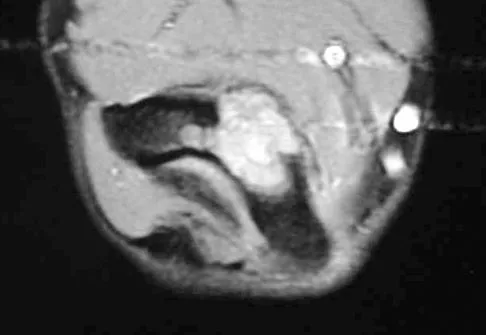 General Orthopedics Board Review 2026: High-Yield MCQs (Set 6) - Figure 109
