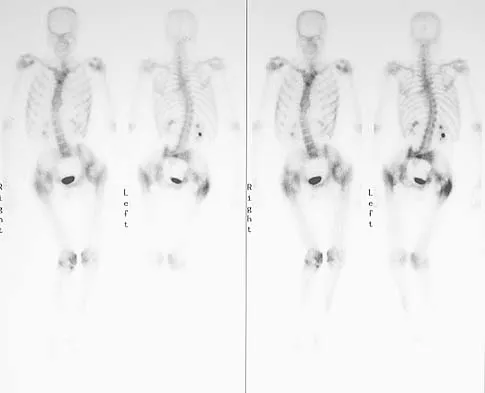 General Orthopedics Board Review 2026: High-Yield MCQs (Set 6) - Figure 113