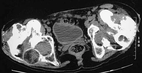 General Orthopedics Board Review 2026: High-Yield MCQs (Set 6) - Figure 114