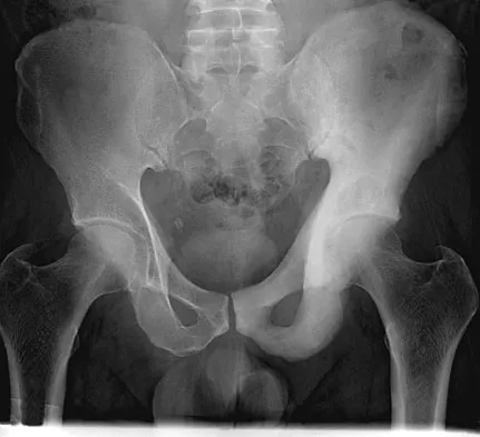 General Orthopedics Board Review 2026: High-Yield MCQs (Set 6) - Figure 117