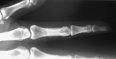 General Orthopedics Board Review 2026: High-Yield MCQs (Set 6) - Figure 122