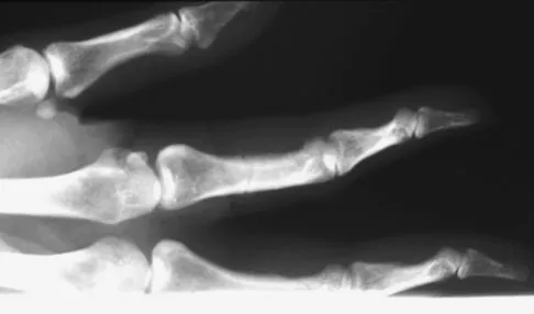 General Orthopedics Board Review 2026: High-Yield MCQs (Set 6) - Figure 123