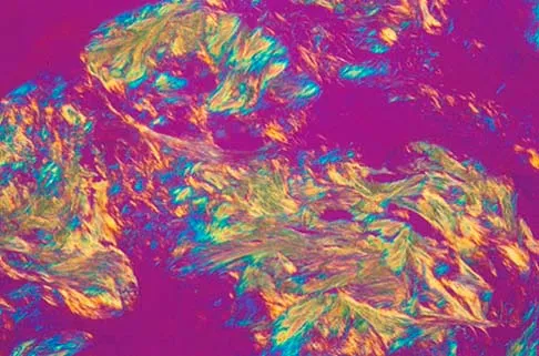 General Orthopedics Board Review 2026: High-Yield MCQs (Set 6) - Figure 16