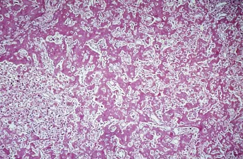 General Orthopedics Board Review 2026: High-Yield MCQs (Set 6) - Figure 31