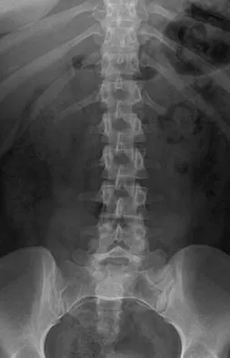 General Orthopedics Board Review 2026: High-Yield MCQs (Set 6) - Figure 32