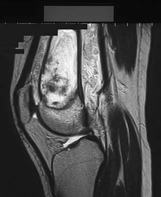 General Orthopedics Board Review 2026: High-Yield MCQs (Set 6) - Figure 35