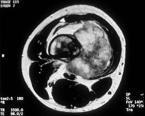 General Orthopedics Board Review 2026: High-Yield MCQs (Set 6) - Figure 4
