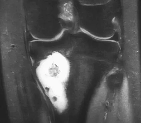 General Orthopedics Board Review 2026: High-Yield MCQs (Set 6) - Figure 41