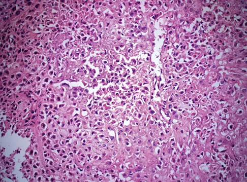 General Orthopedics Board Review 2026: High-Yield MCQs (Set 6) - Figure 45