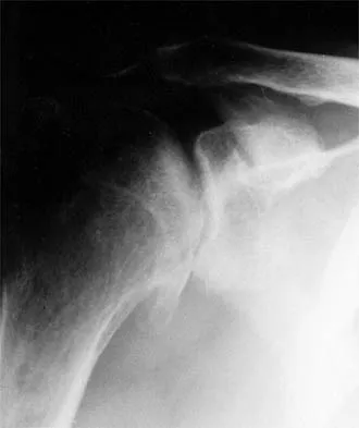 General Orthopedics Board Review 2026: High-Yield MCQs (Set 6) - Figure 47